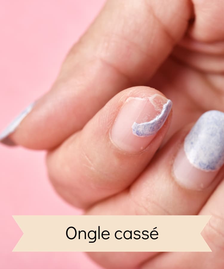 reparation-ongle-casse